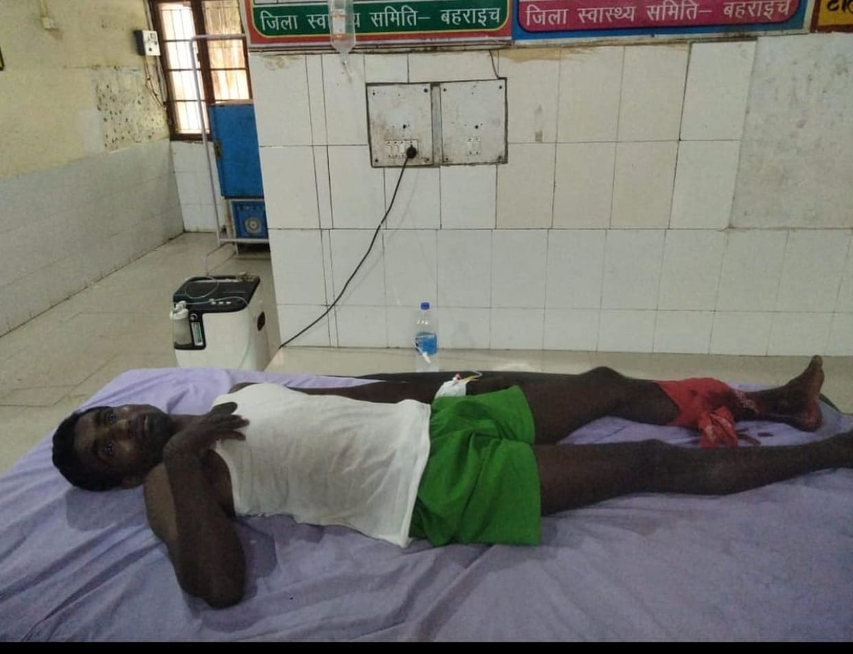 Crocodile attacked young man, injured