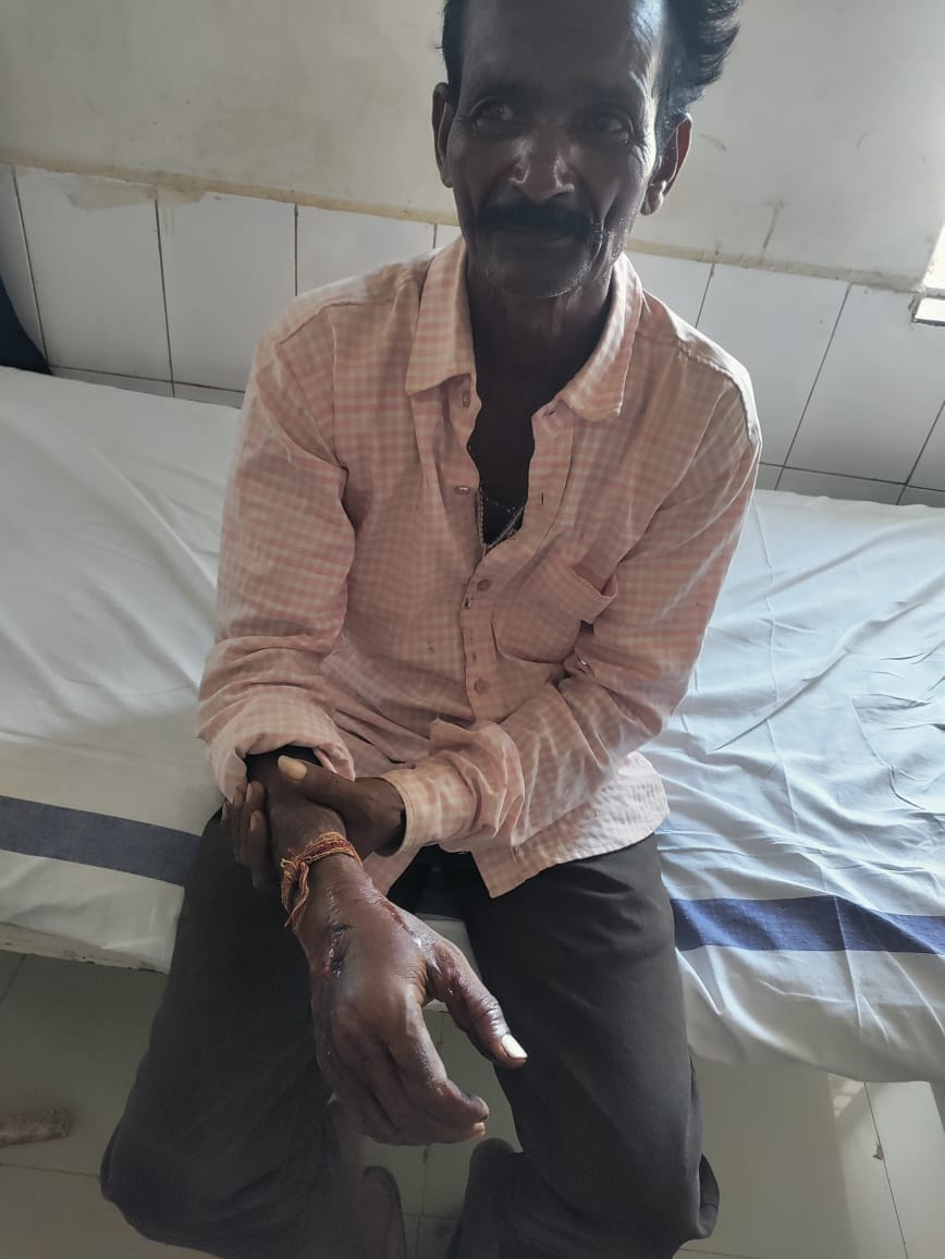Crocodile attacked shepherd In Damoh, Fourth Incident In as many days