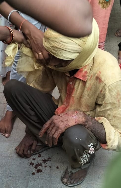 Tiger attacks farmer who went to irrigate his field, creates ruckus