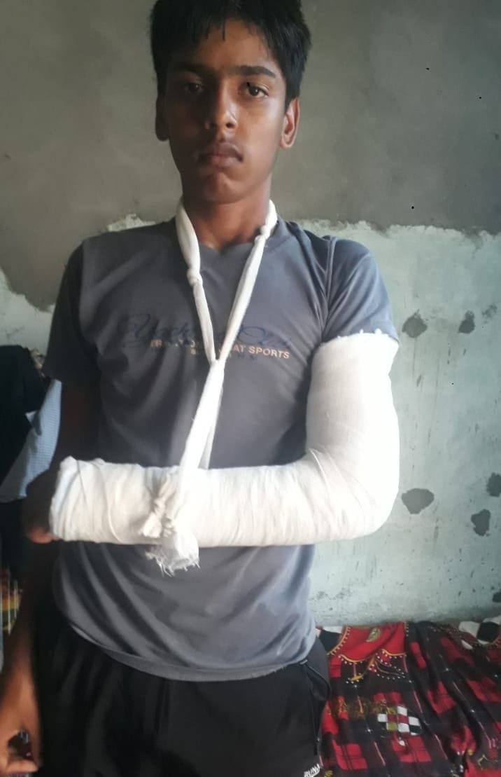 Teacher beats 10th class student so much that his hand is broken