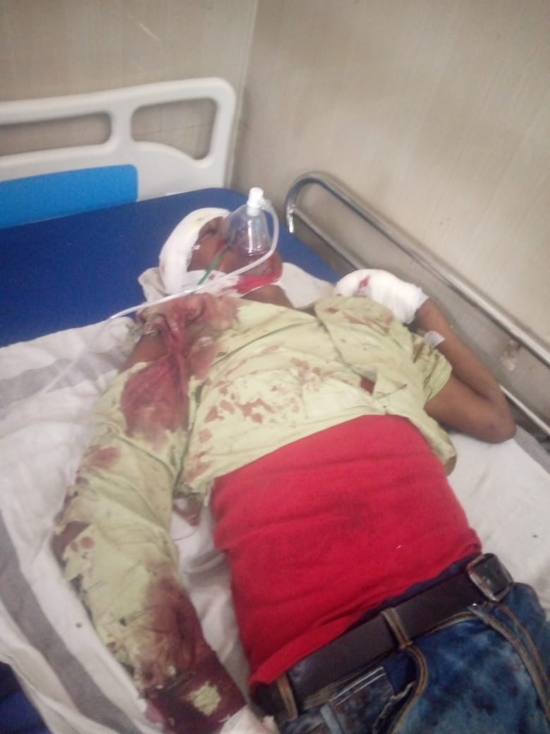 Youth Injured Found On Railway Tracks Jabalpur Referred For Treatment