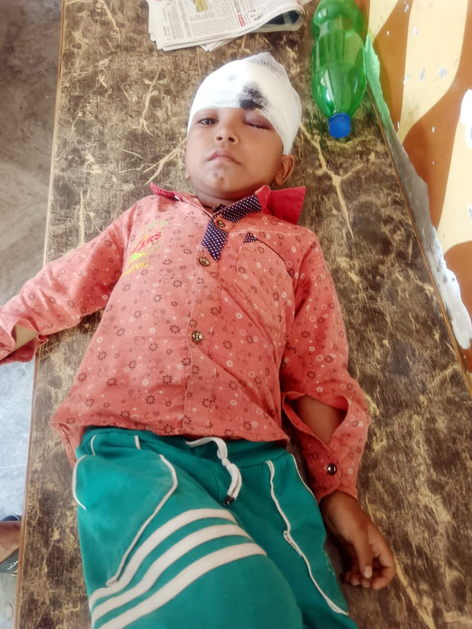 Monkeys chased innocent child, he fell from the roof and got injured