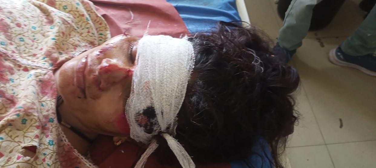 Bus crushes scooter-riding couple, condition critical