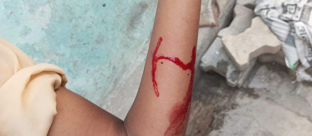 Teenager attacked with knife and her aunt attacked with rod