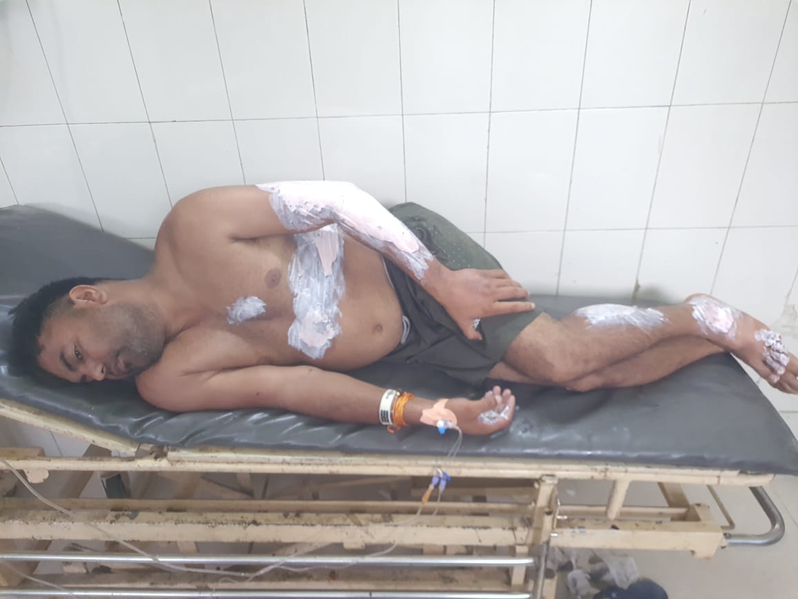 Kanwad got entangled in high tension line, one Kanwadiya got burnt