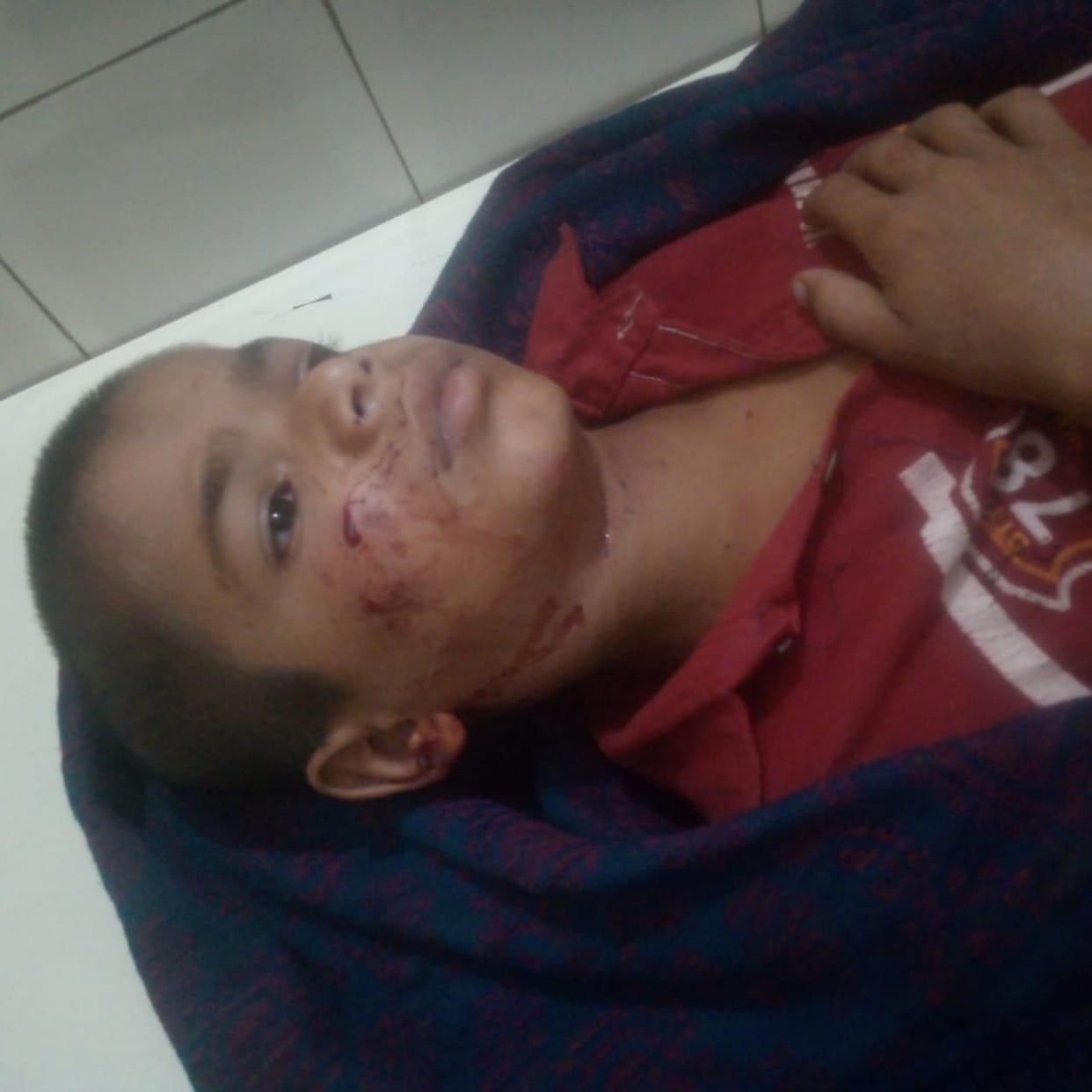 Wolf attacked and injured another child