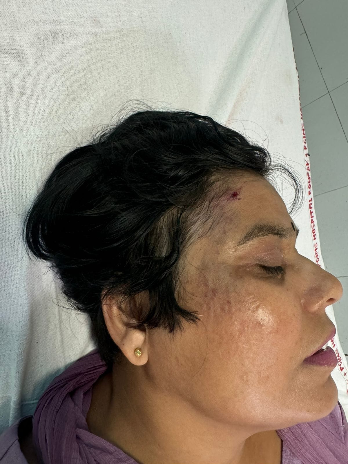 Nursing officer side hit by police dead body, driver accused of trying to escape