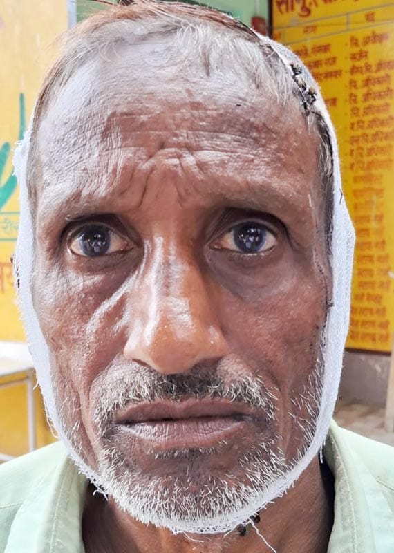 A customer was stabbed for complaining about worms in guava