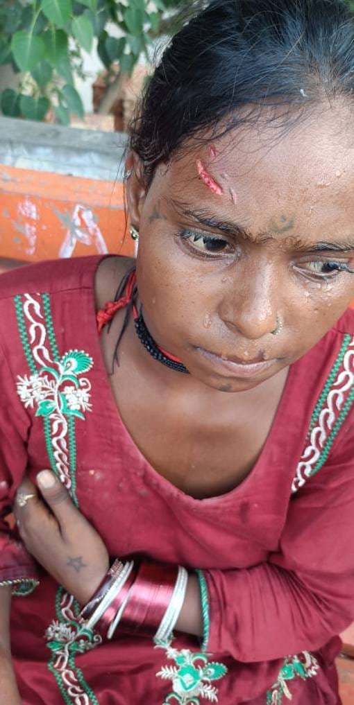 A pack of dogs attacked a woman, scratched her body at 8 places
