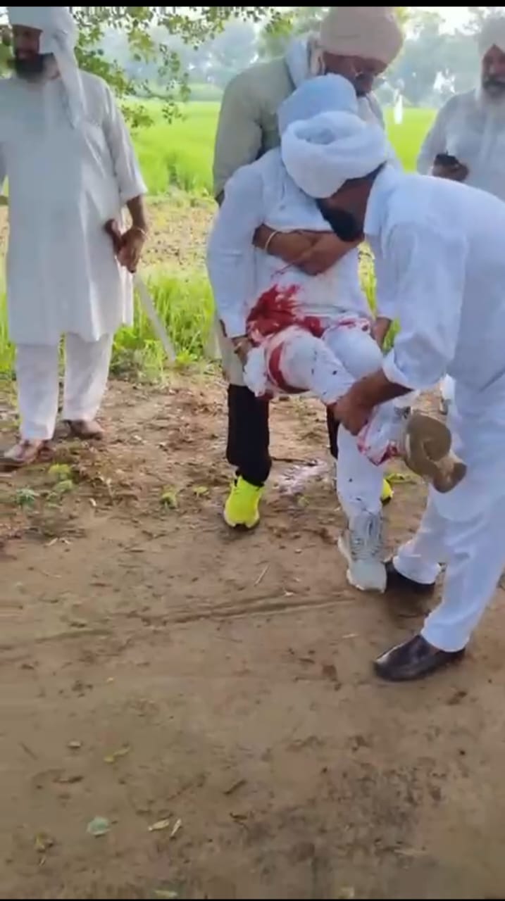 30 minutes firing for 11 acres of land in Jeevan Nagar, condition of two among eight injured is critical