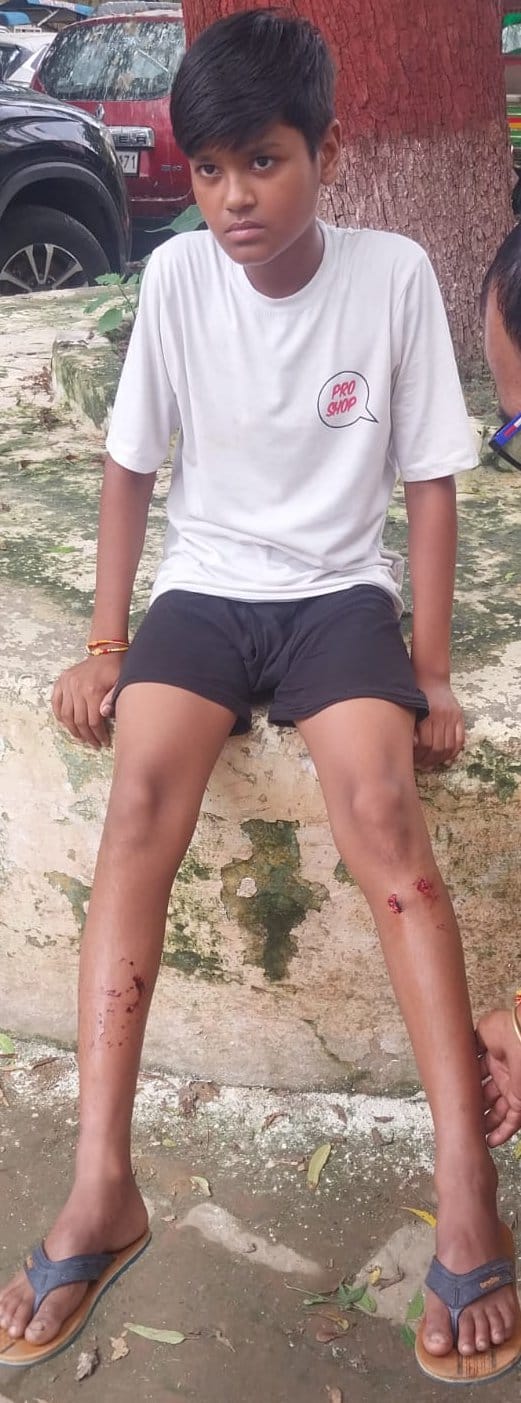 Two teenagers playing on the terrace were attacked and injured by a pit bull.