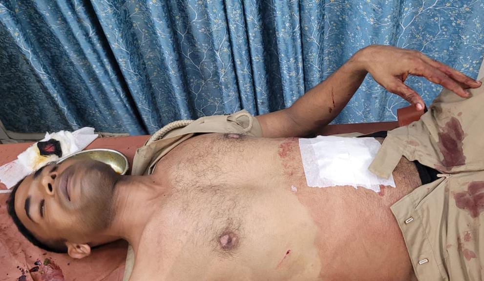 The constable who arrived after getting information about the dispute between the brothers was stabbed and injured