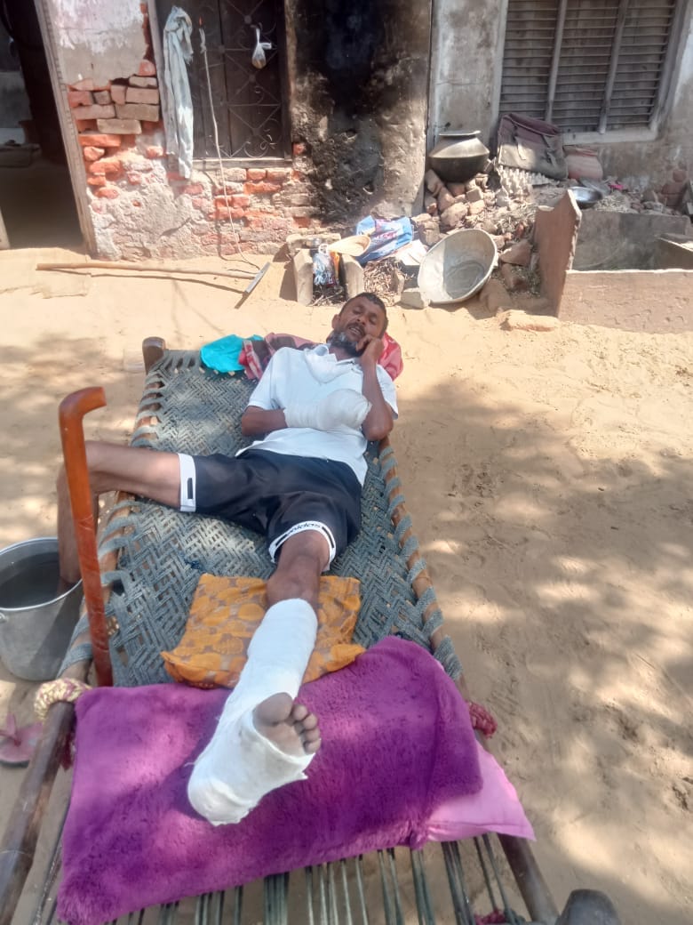 Dogs and monkeys create havoc, so far 800 people have reached for treatment
