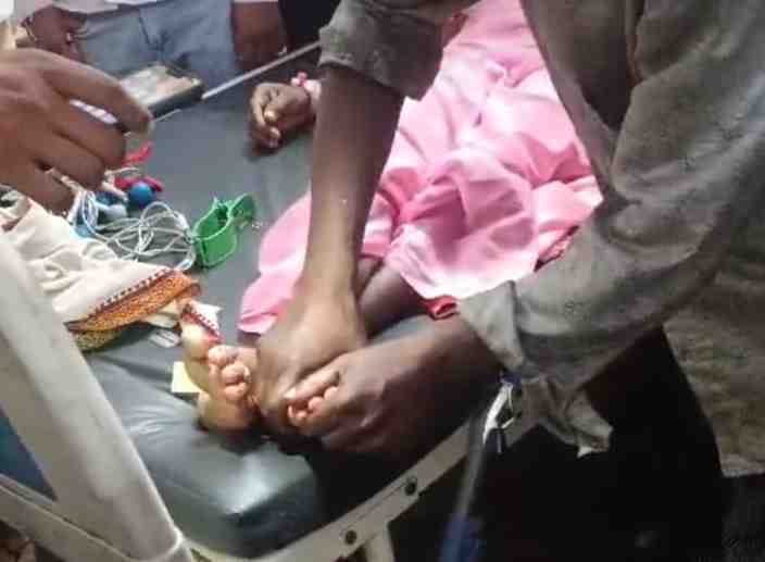 Woman dies due to snakebite, Baygir performs exorcism in medical college
