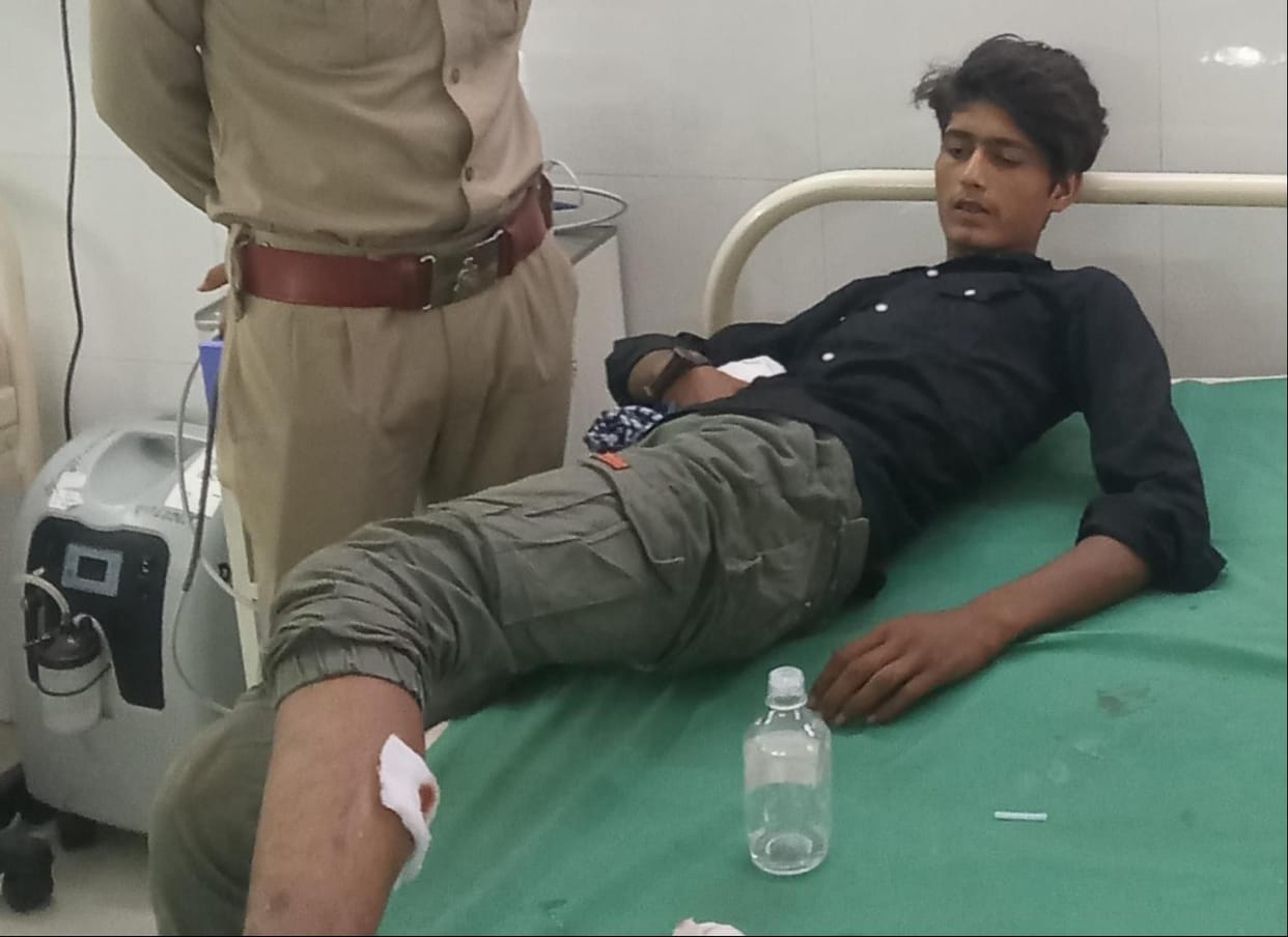 Criminal injured in police encounter, two stolen guns recovered