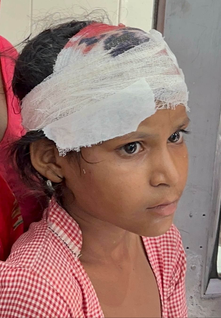 A student was injured when a dilapidated part of the roof fell in a council school