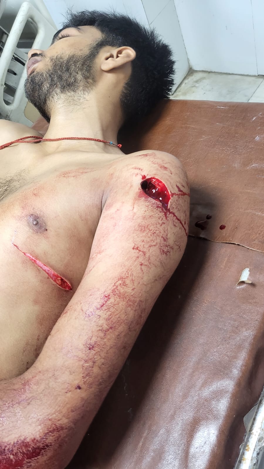 Jind youth seriously injured after knife attack in MDU Law Department's fresher's party