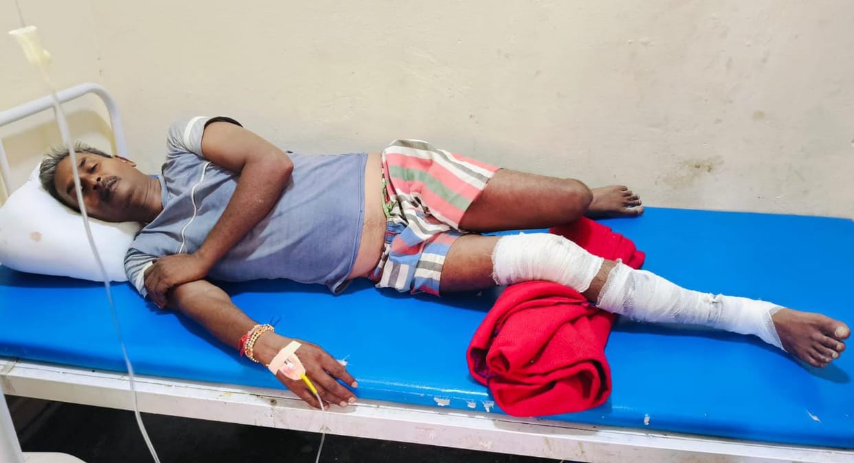 Villager injured in crocodile attack