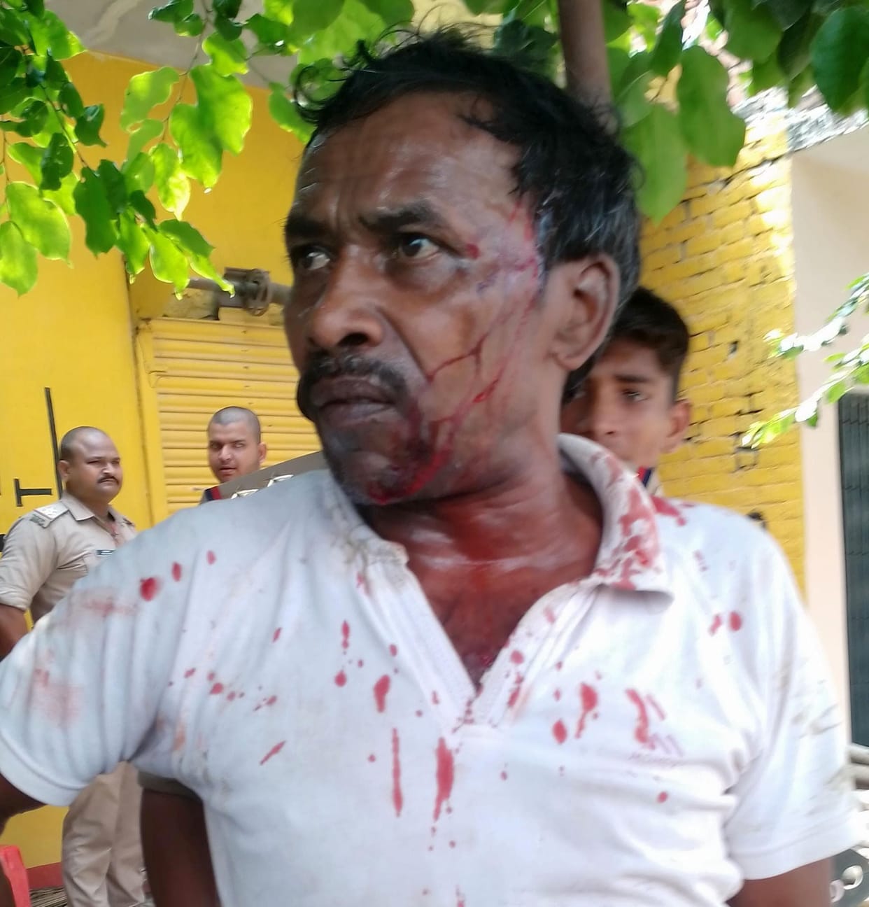 Fighting in land dispute, five injured including advocate