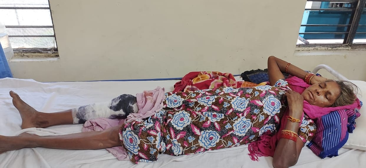 Woman injured in crocodile attack