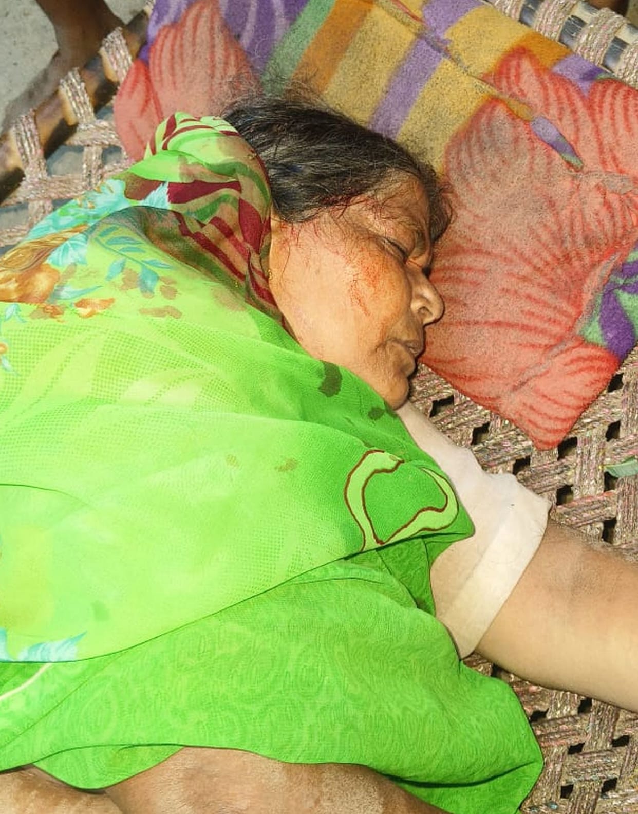 Two more injured in langur attack, villagers protest against forest department