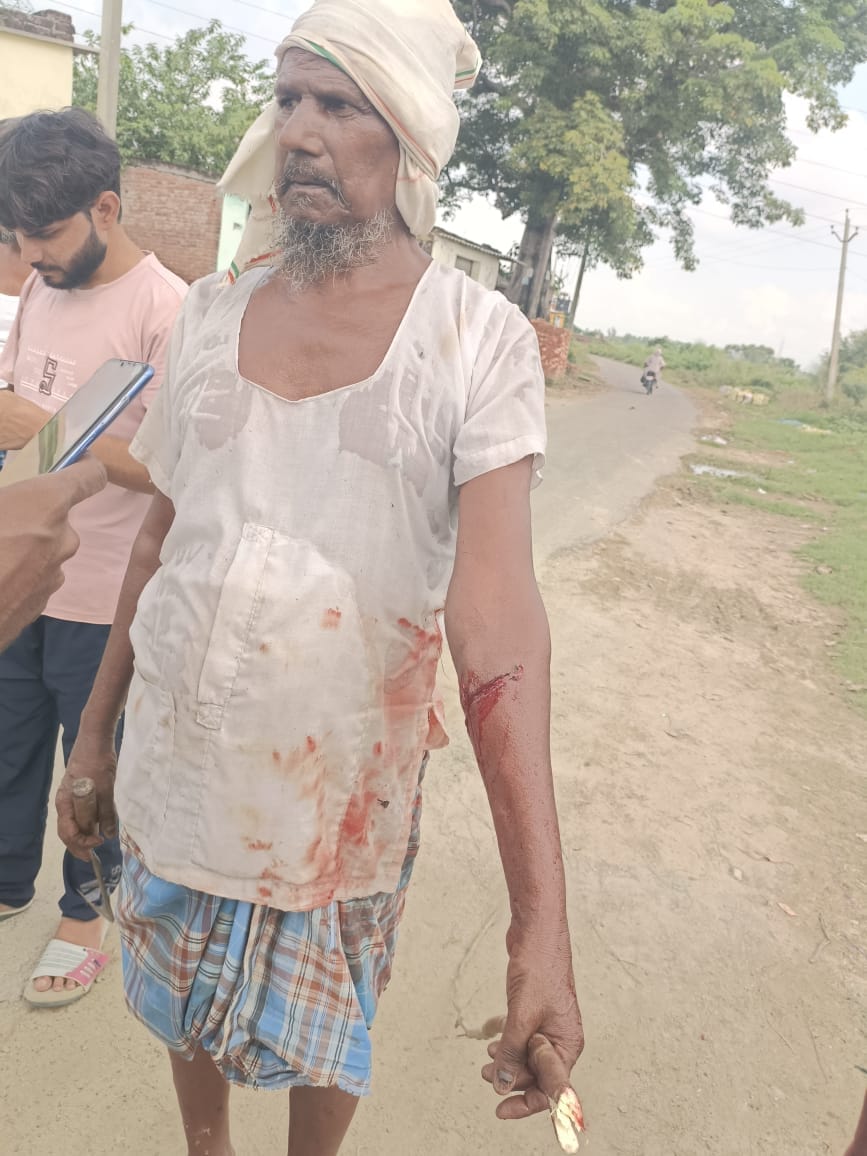 10 people including two innocent children injured in jackal attack in Pilibhit