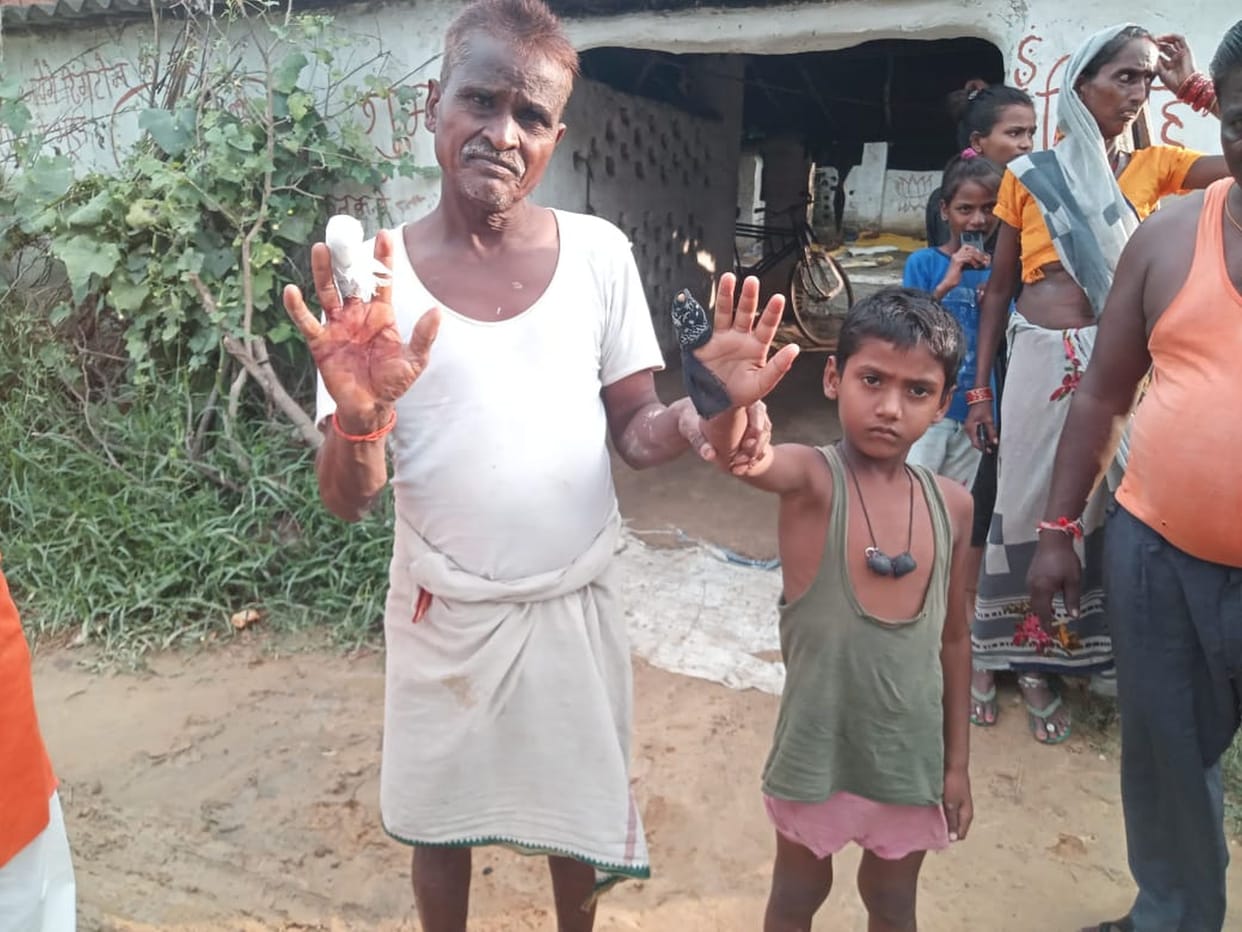 Three injured in jackal attack, killed by villagers