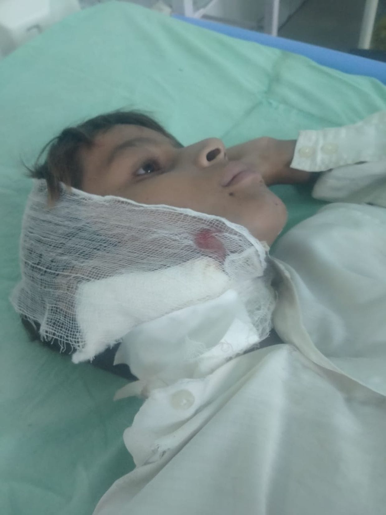 Wolf attacks teenager lying on rooftop, referred