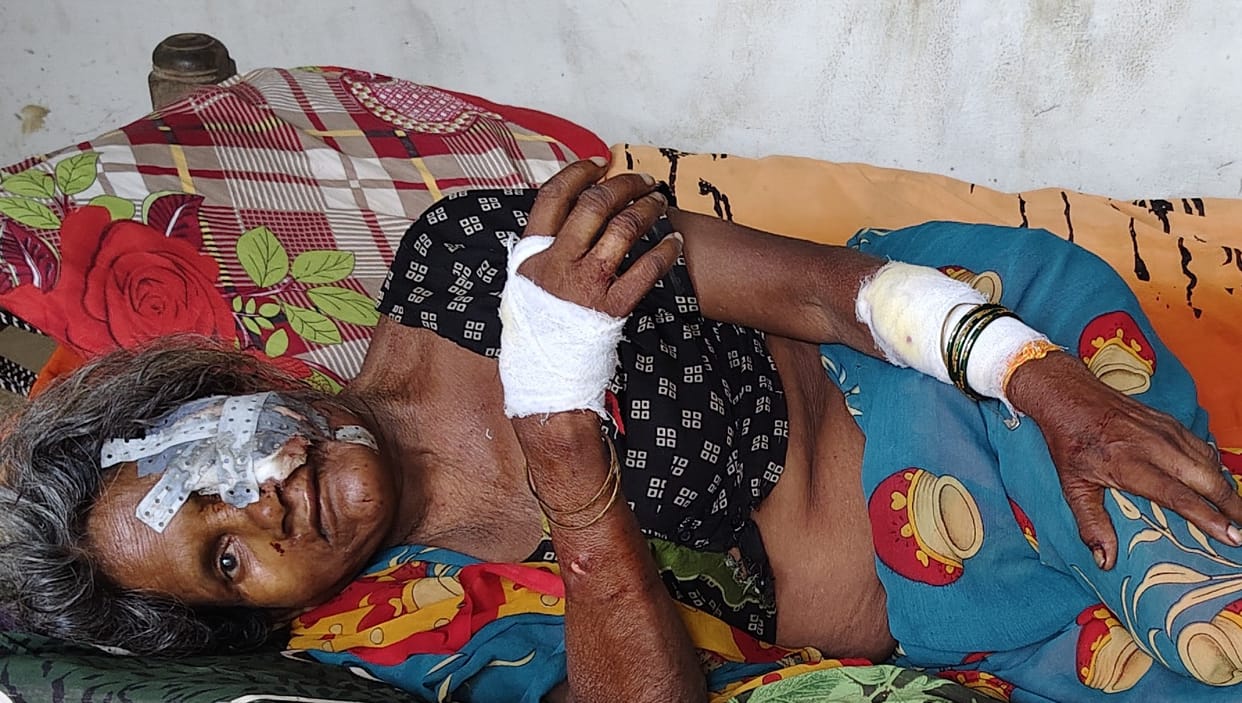 Fear of attack by violent animals... 24-hour surveillance in villages