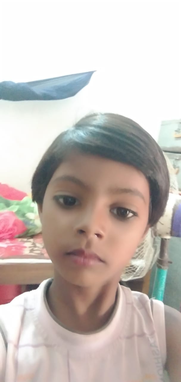 One girl died due to diphtheria, two were in critical condition