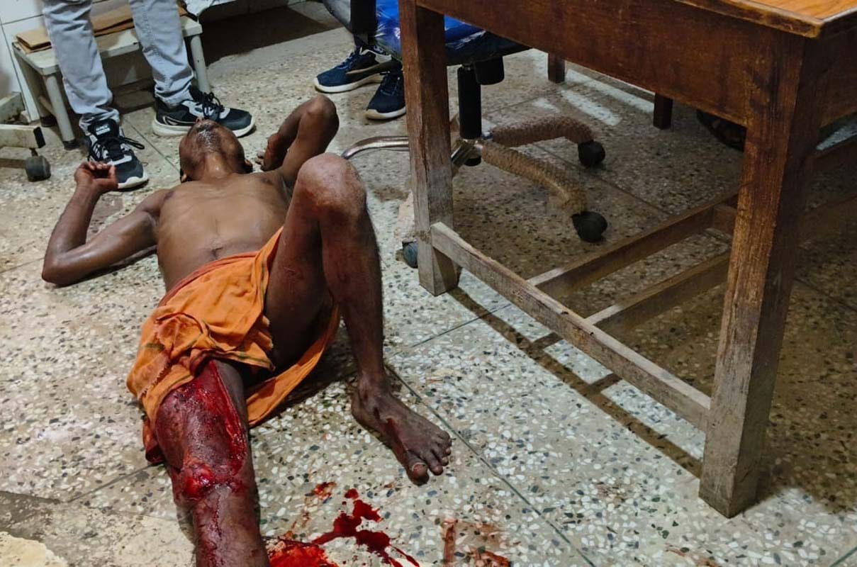 Seriously injured young man made to lie down on the dirty floor of the emergency