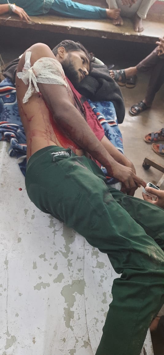 Youth injured in tiger attack