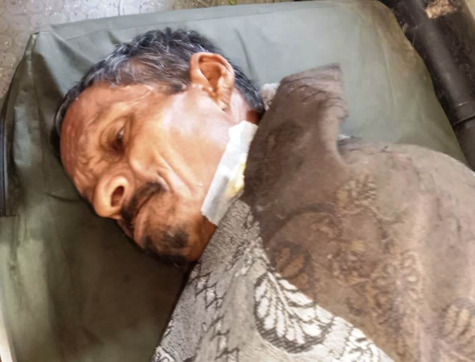 Tiger attacks laborer who went to pluck sugarcane leaves