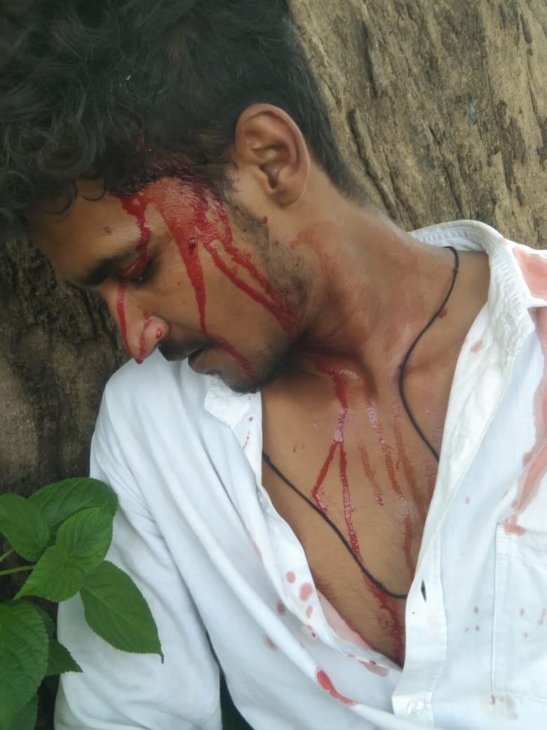 Shahdol News To repay the loan, the young man conspired to kidnap himself