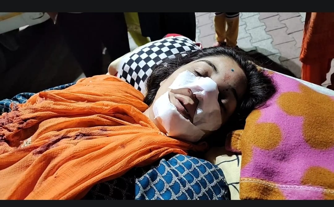 Fight over land dispute, sister-in-law broke sister-in-law's leg with a rod, Tanda referred