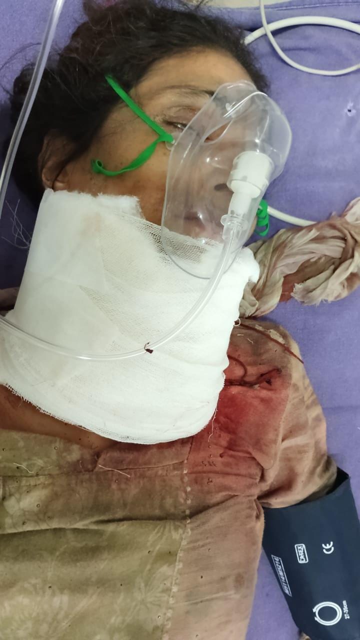 Attempted suicide by slitting the throats of his wife and son