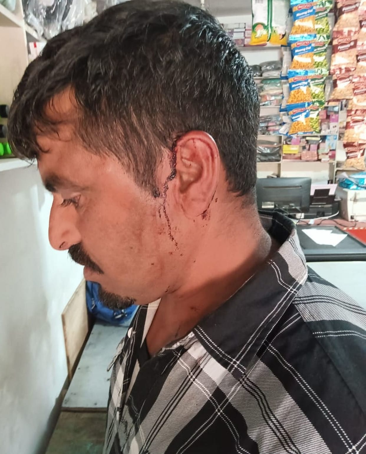 Teacher accused of beating the cook with a stick, parents are also not sending their children to school