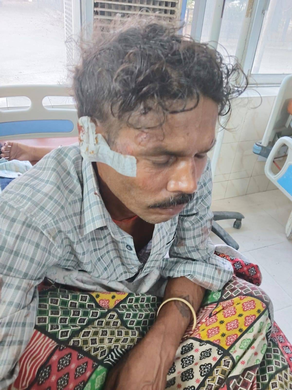 Firing entered the house on the night of Diwali, father and daughter were shot, case registered against the couple