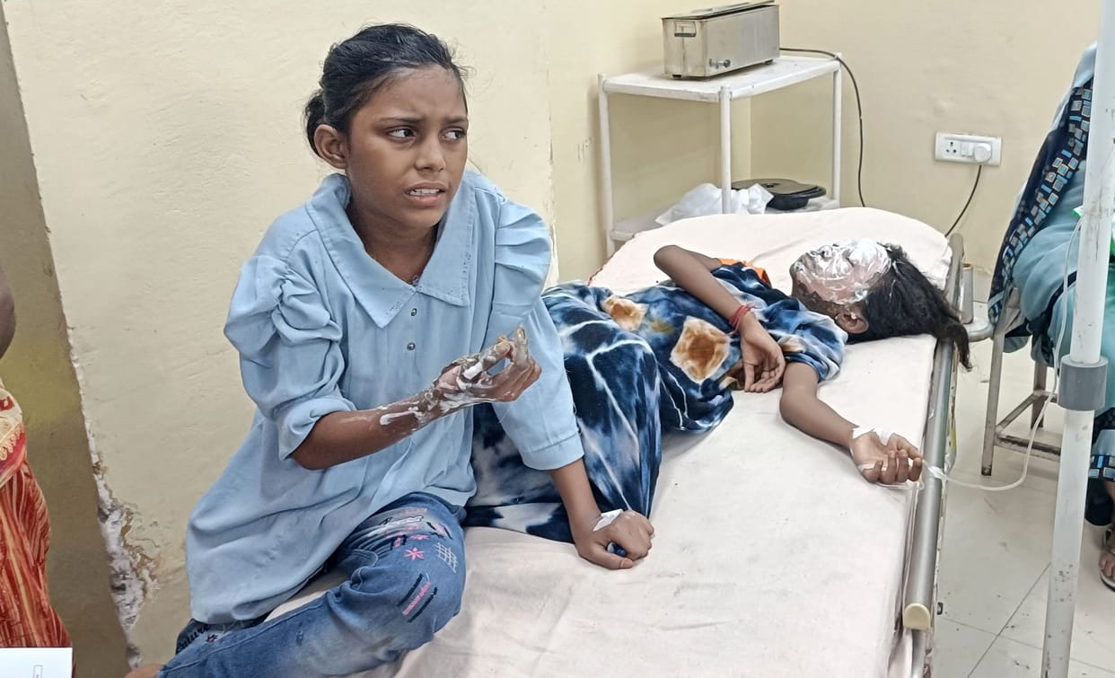 Two sisters got burnt while burning firecrackers, reached emergency department in critical condition