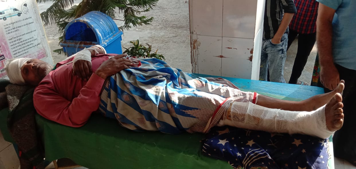 Father's leg broken after being attacked with an iron rod, case