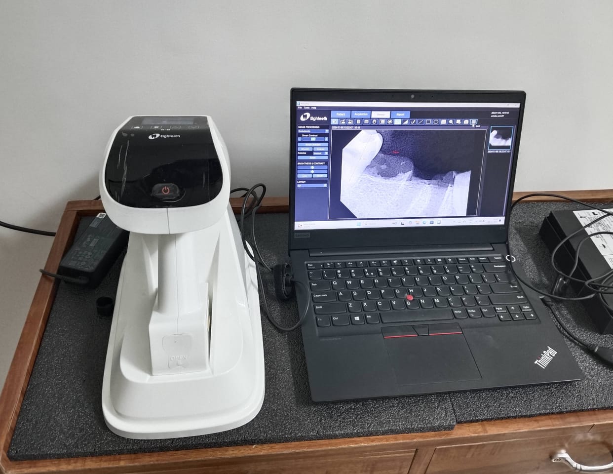 You will get your dental X-ray report in two minutes