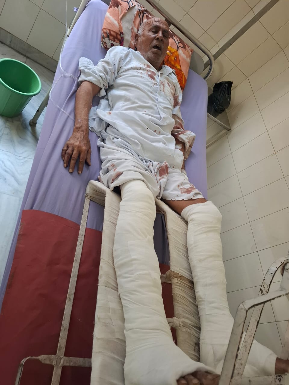 79 year old man attacked by son, daughter in law and grandson in village Gindra