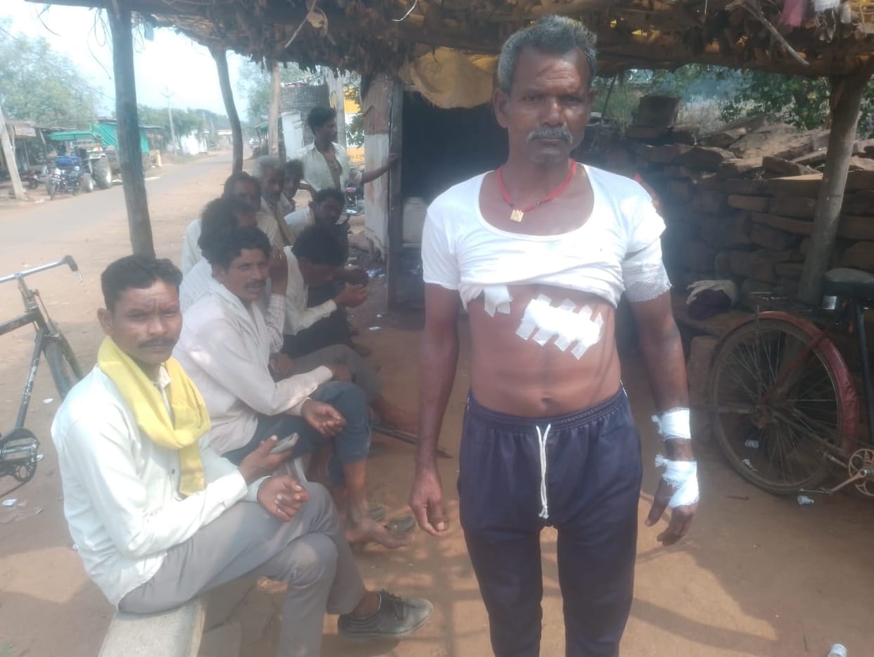 Damoh Leopard attacked farmer who went to start machine in field he was brought to hospital injured condition