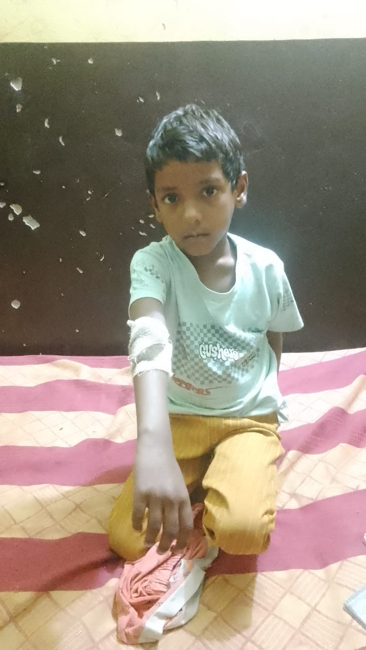 Terror of monkeys and dogs in Nawabganj, 25 people were killed in a day and 750 people in a month.