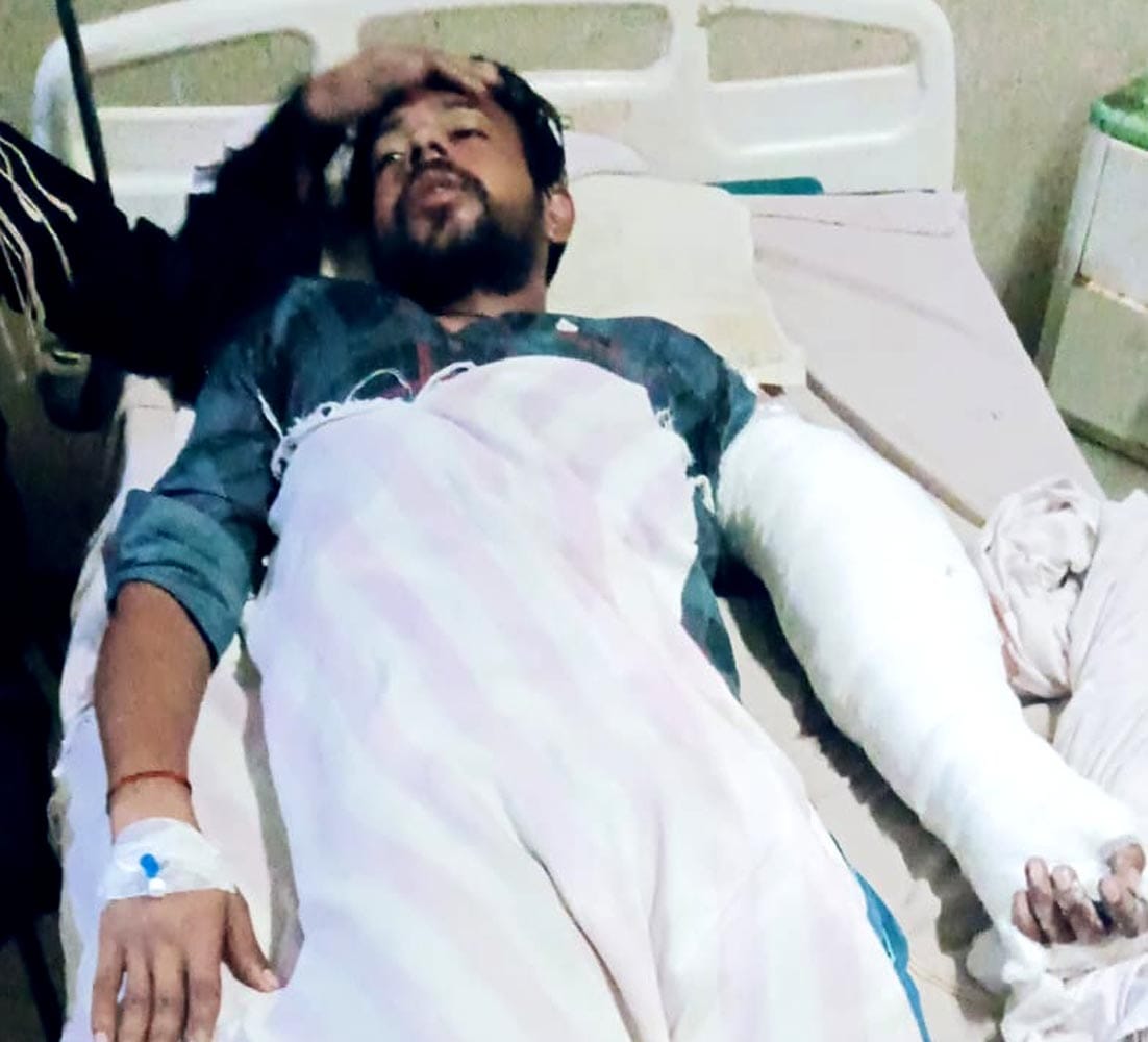 A young man sitting with his hand out of the window got injured when his hand got rubbed against another vehicle