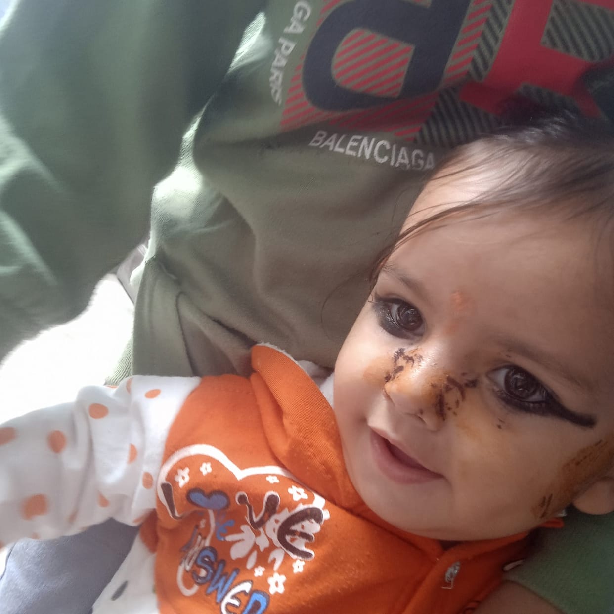 12 children injured in monkey attack