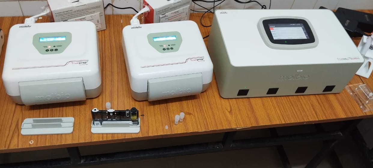 Now TV tests will be done in Galod Hospital