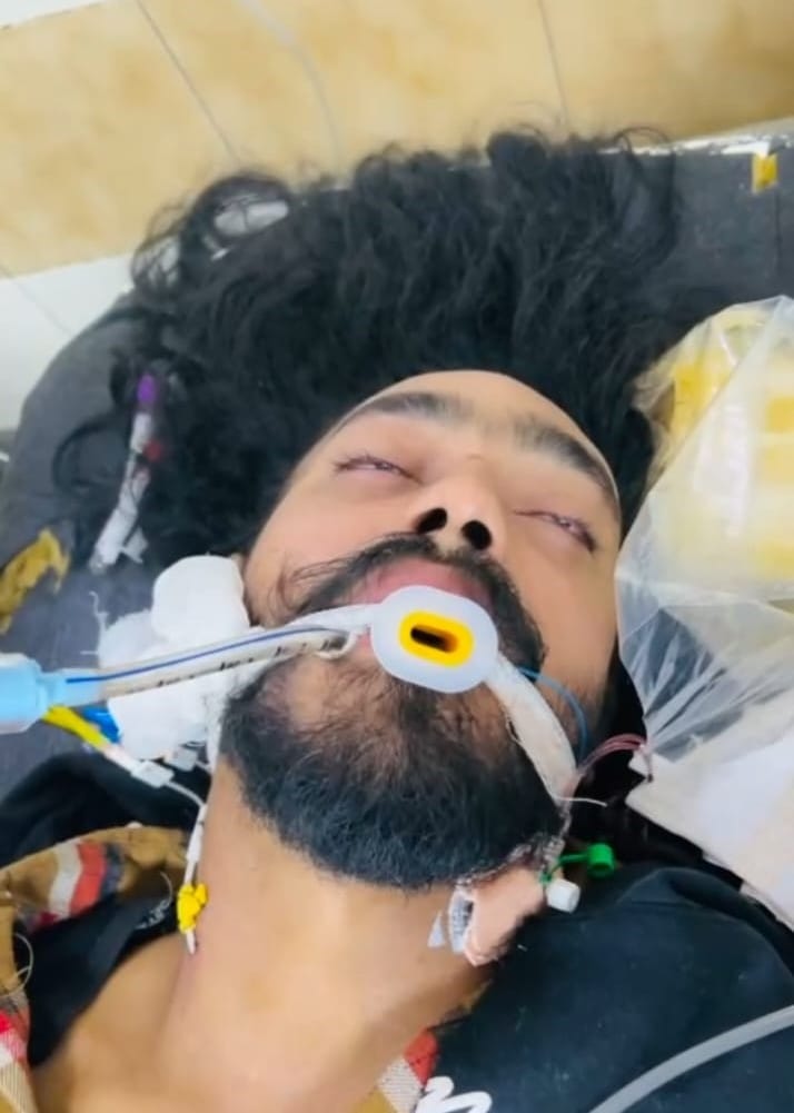 Youth injured after being hit by car, police registered case