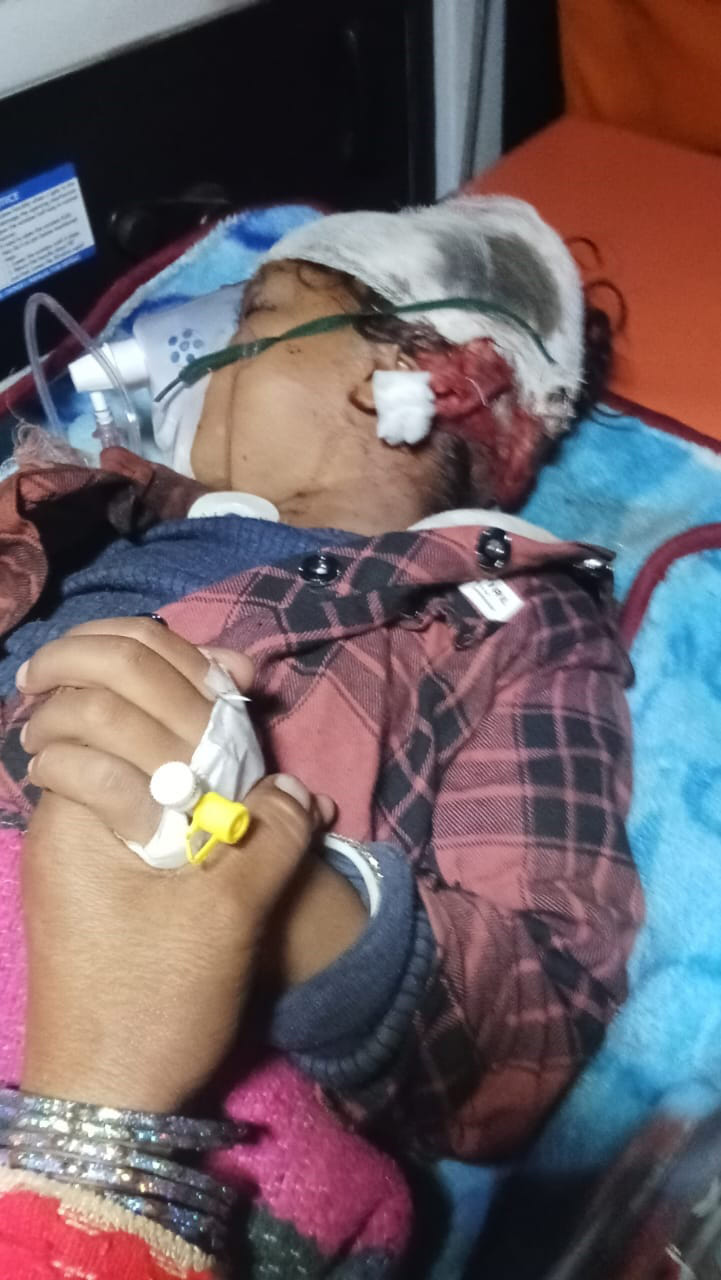 A pickup ran over a girl, she was seriously injured