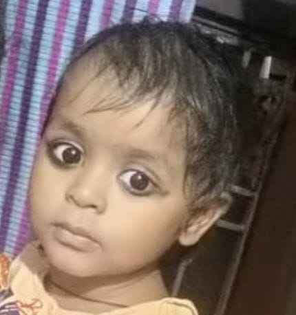 Girl collides with boiling water vessel, burns to death